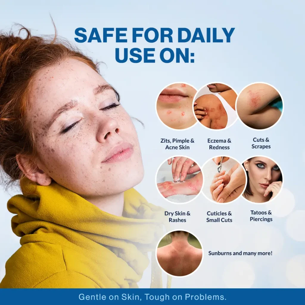 Aqua Protego 200ppm HOCl face cleanser safe for daily use on acne-prone and oily skin